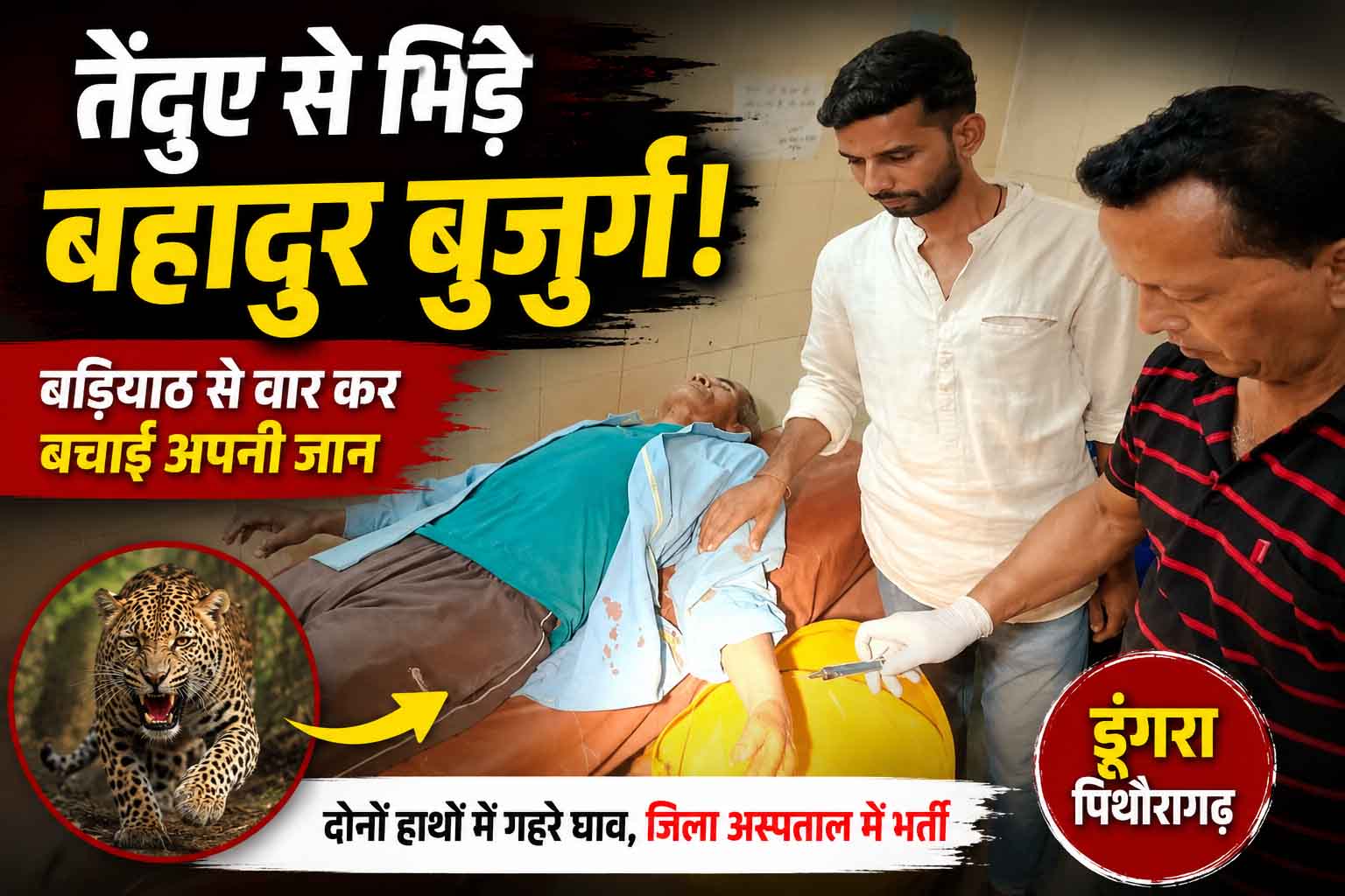 तेंदुए से भिड़े 62 वर्षीय बुजुर्ग, बड़ियाठ से वार कर बचाई जान