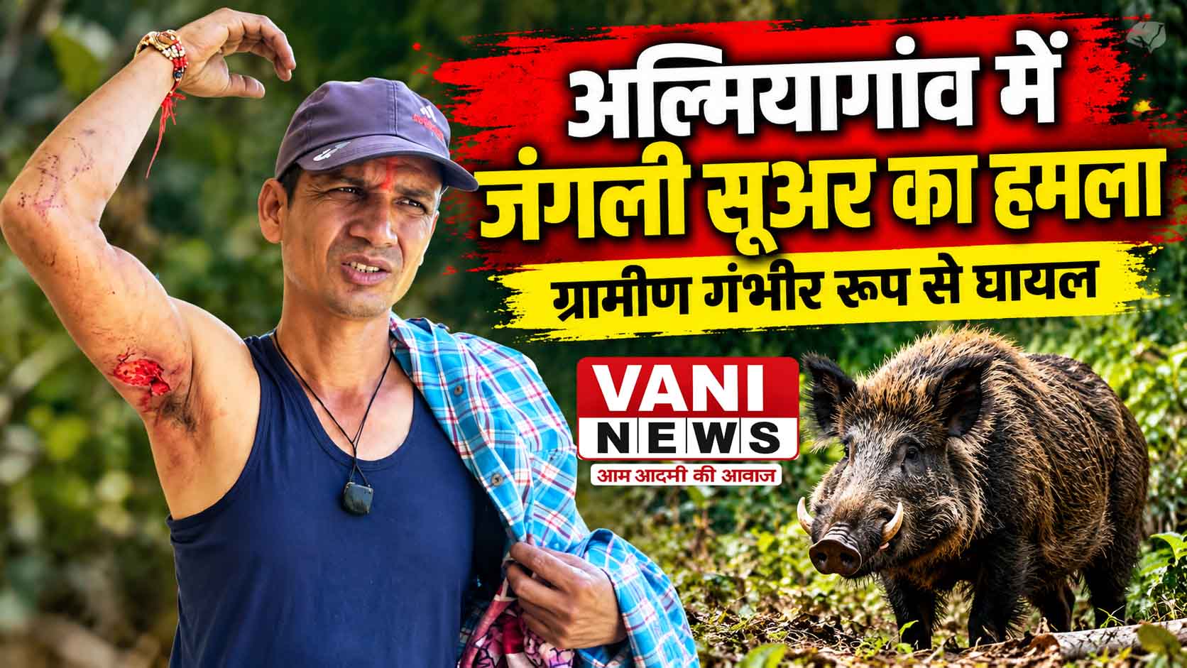 अल्मियागांव में जंगली सूअर का हमला, राजेंद्र प्रसाद घायल; थल क्षेत्र में बढ़ते वन्यजीव संघर्ष से ग्रामीणों में दहशत