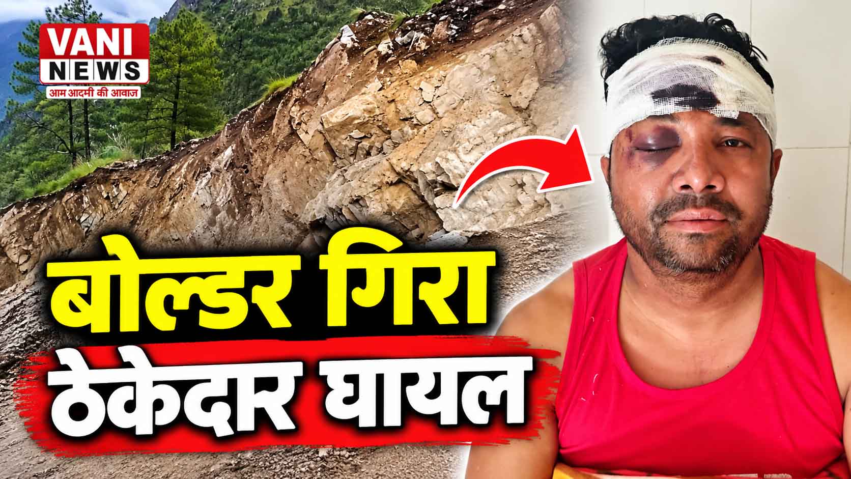 बोल्डर गिरने से ठेकेदार घायल, संदीप वर्मा बोले—“डायनामाइट ब्लास्टिंग हुई ही नहीं”