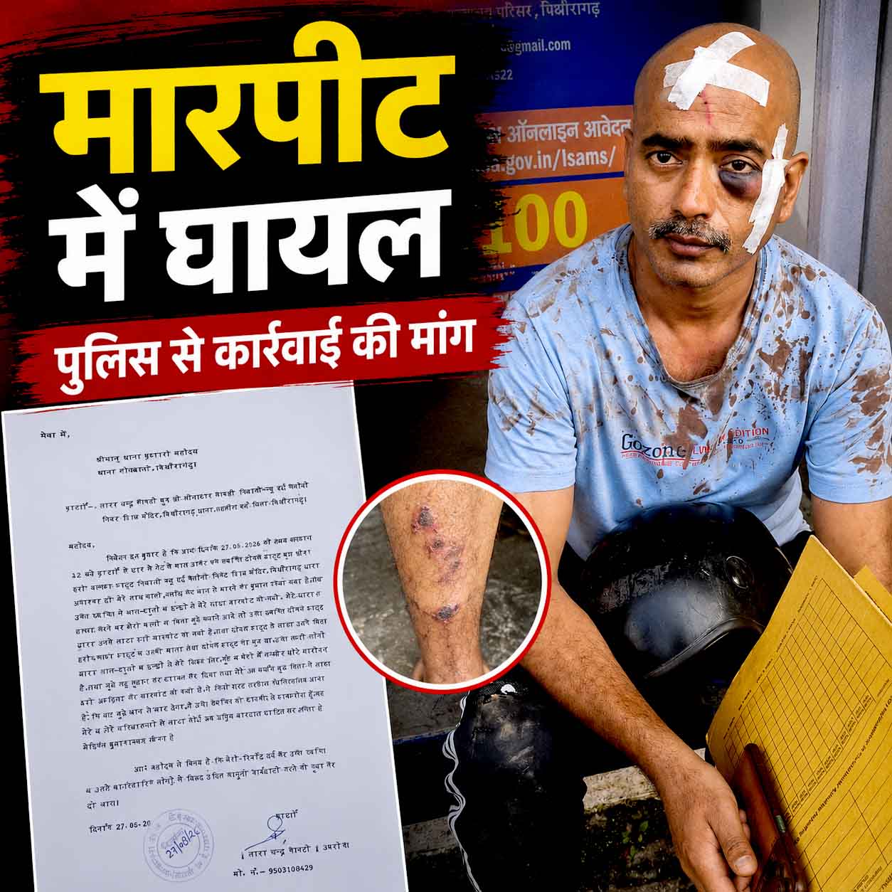 घर के गेट पर युवक ने किया हमला! मारपीट में व्यक्ति घायल, शरीर पर चोटों के निशान